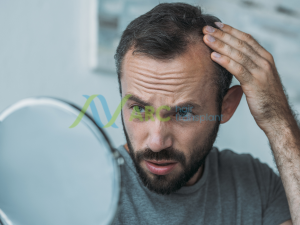 When Hair Loss Typically Starts Male Hair Loss