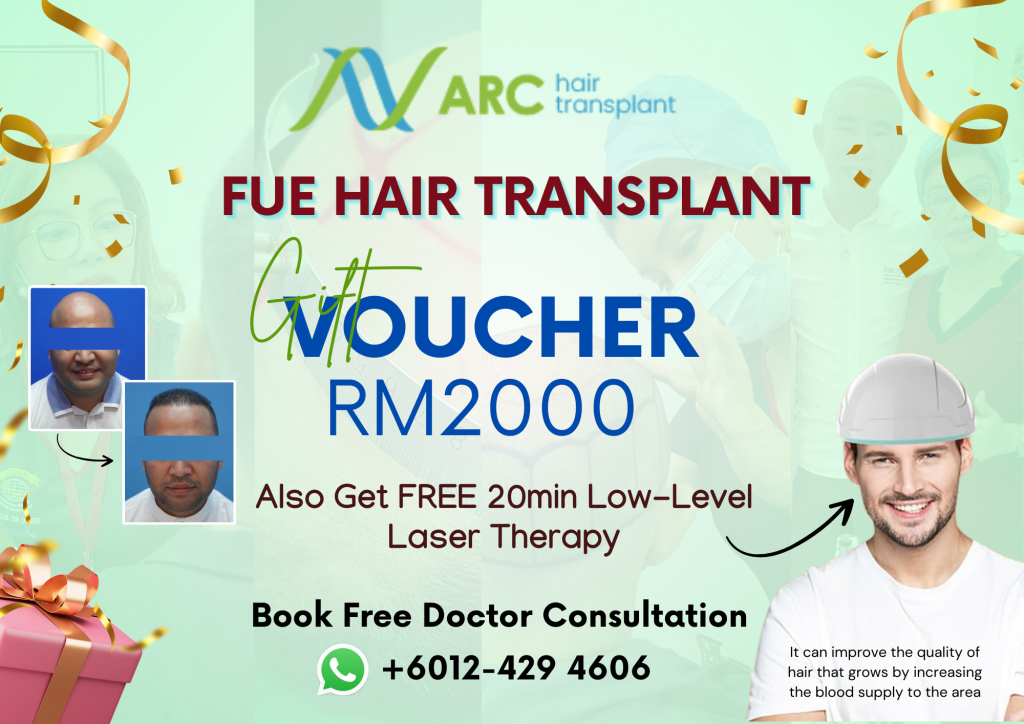 ARC Hair Transplant - Get Voucher popup image