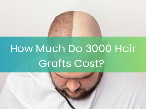 Hair Transplant Malaysia - How Much Do 3,000 Hair Grafts Cost