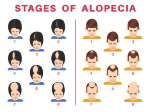 bald spots