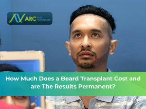 How much does a beard transplant cost and are the results permanent?