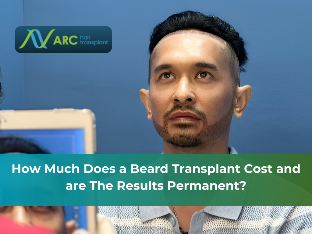 How Much Does a Beard Transplant Cost and are The Results Permanent