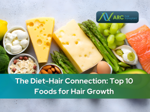 The Diet-Hair Connection: Top 10 Foods for Hair Growth